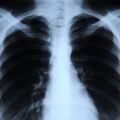 Tüdőszűrés